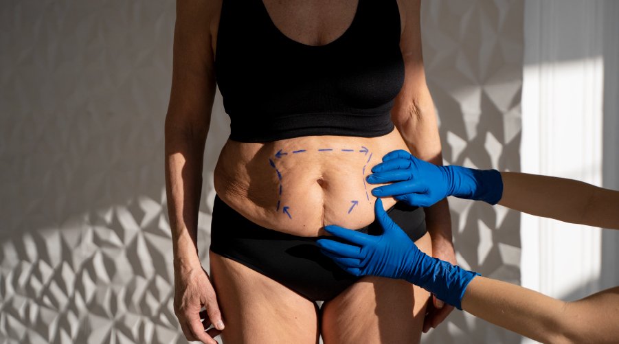 Cirurgia plástica estética: quando o médico deve indenizar?